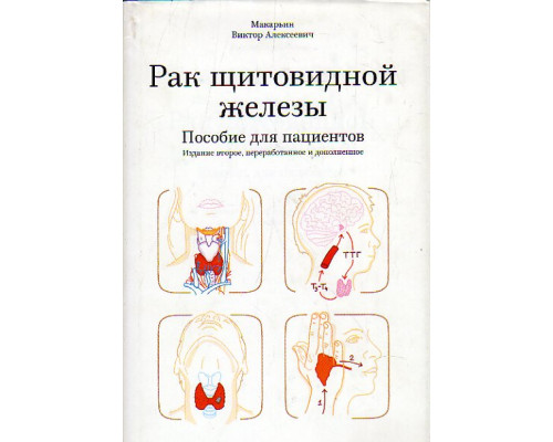 Рак щитовидной железы: пособие для пациентов