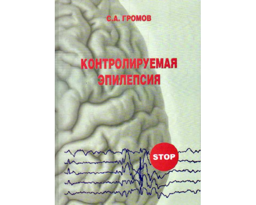 Контролируемая эпилепсия. Клиника, диагностика, лечение