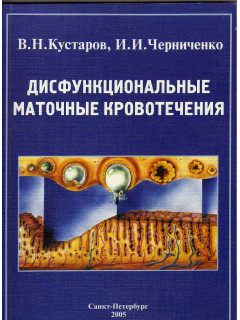 Дисфункциональные маточные кровотечения