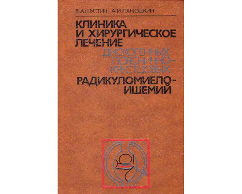 Клиника и хирургическое лечение дискогенных пояснично-крестцовых радикуломиелоишемий.