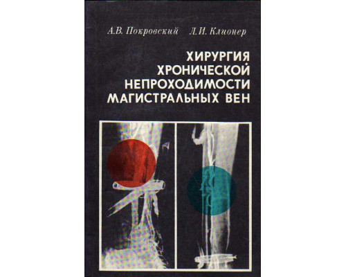 Хирургия хронической непроходимости магистральных вен. 