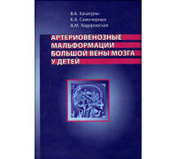 Артериовенозные мальформации большой вены мозга у детей.