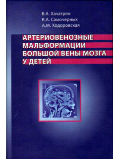 Артериовенозные мальформации большой вены мозга у детей.