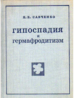 Гипоспадия и гермафродитизм.