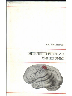 Эпилептические синдромы