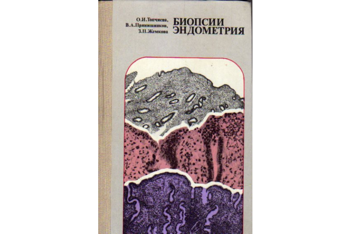 Книга Биопсии эндометрия (Топчиева О. И., Прянишников В. А., Жемкова З. П.)  1978 г. Артикул: 11168699 купить