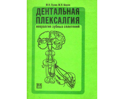 Дентальная плексалгия. Невралгия зубных сплетений.