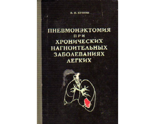 Пневмонэктомия при хронических нагноительных заболеваниях легких